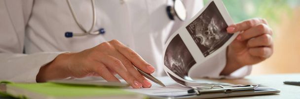 Female doctor working with ultrasound results of patients at her working desk. Diagnostic of diseases and medical paperwork concept. - 写真・画像
