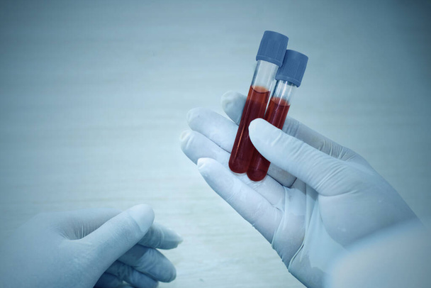 Mano de un médico sosteniendo una botella de muestra de sangre. - Foto, Imagen