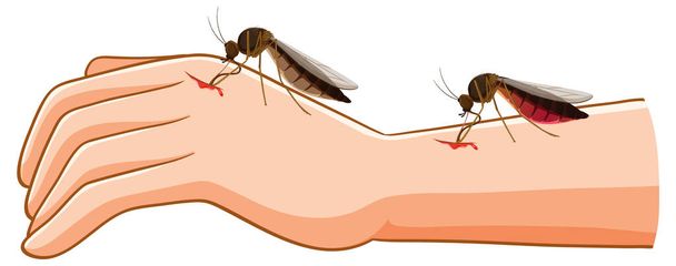 Vector cartoon illustration of a mosquito biting a human arm and extracting blood - Vector, Image