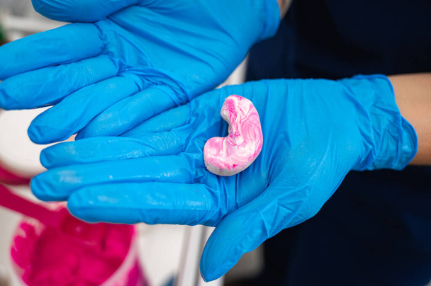 Ένας γιατρός γεμίζει το ακουστικό κανάλι ενός ασθενούς με ένα υλικό σιλικόνης, ροζ, κατασκευασμένο χρησιμοποιώντας μια σύριγγα για την κατασκευή ωτοβυσμάτων σε μια κλινική ακοής. Παραγωγή ενθέτων κατόπιν παραγγελίας - Φωτογραφία, εικόνα