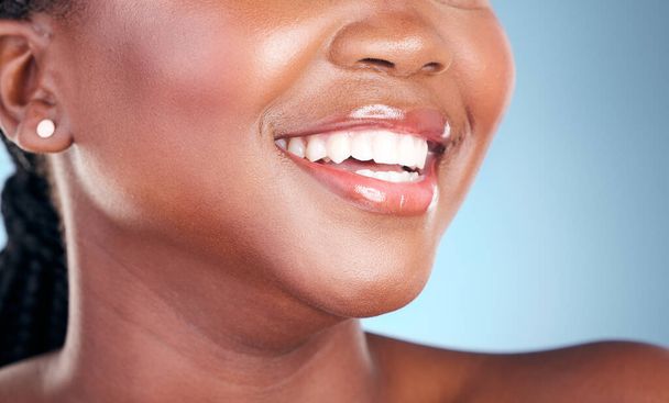 Γυναίκα, δόντια και χαμόγελο στον οδοντιατρικό καθαρισμό, την υγιεινή ή τη θεραπεία σε ένα μπλε φόντο στούντιο. Κλείσιμο του γυναικείου στόματος σε λεύκανση δοντιών, στοματική ή τσίχλα υγειονομικής περίθαλψης για υγιή ευεξία. - Φωτογραφία, εικόνα