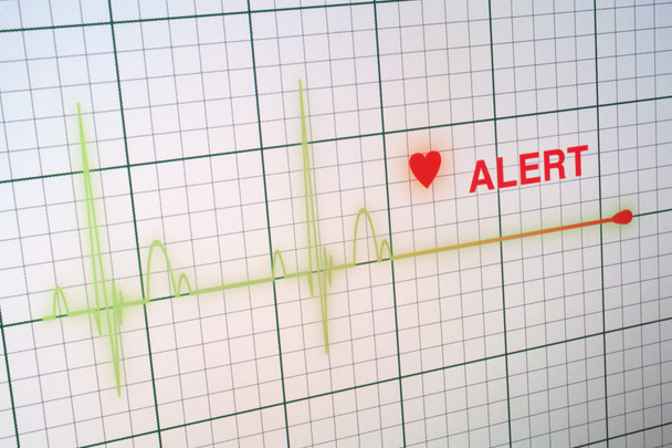 Heart beats cardiogram on the monitor. - Photo, Image