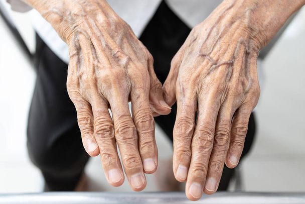 Idős idős nő látható ráncos kezek és kidudorodó véna a kézfejen, vénák jelentősebb, bőrelváltozások, problémák a bőr és a szövetek vékonyodhat, és elveszíti rugalmasságát, vénák kidudorodni - Fotó, kép