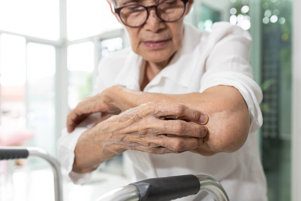 Vanhukset raapivat käsivartta kyynärpäätä kutiava iho, ihoärsytys, atooppinen ihottuma tai hermojen ja hermoston häiriöt, neurologiset sairaudet, kutina tuntemukset ilman näkyvää syytä iholla - Valokuva, kuva