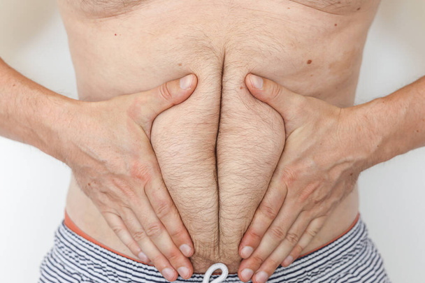 Tuntematon lihavuus mies koskettaa rasvaa ja selluliittia vatsa vyötärö kärsii ylimääräistä painoa. Epäterveellisen ruokavalion ja elämäntavan käsite, liikalihavien ihmisten terveysongelmat, masennus, epävarmuus. - Valokuva, kuva