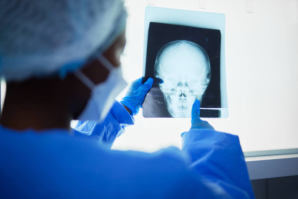 Radiografía cerebral, historial médico y de cirugía, resultados de las pruebas y análisis de la salud de la cabeza. Radiología, neurología y cirujano revisan radiografía de cráneo, anatomía y resonancia magnética para operación hospitalaria. - Foto, imagen