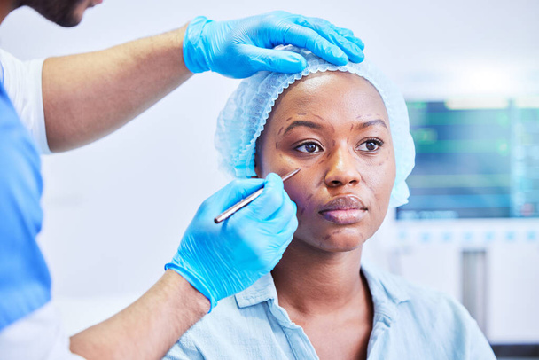 Plastic surgery, pen and black woman in a hospital with dermatology with beauty aesthetics therapist. Surgeon, facial change and filler for skincare, cosmetics and wellness in a clinic with doctor. - Photo, Image