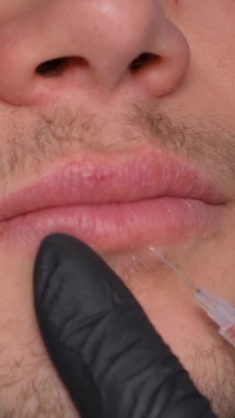 Um cosmetologista dá a uma pessoa uma injeção para aumentar os lábios. Cosmetologia masculina. Vídeo vertical. - Filmagem, Vídeo