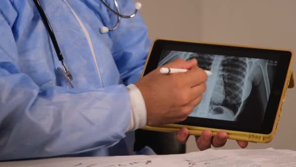 médecin examinant une radiographie pulmonaire. Images 4k de haute qualité - Séquence, vidéo