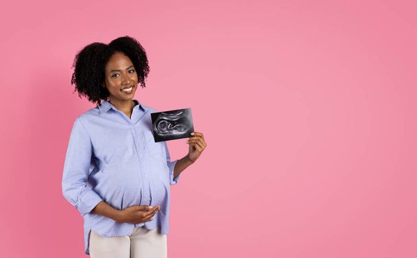 Cheerful young black pregnant woman in casual touching belly, show ultrasound scan, isolated on pink studio background. Ad, offer, health care for mother, lifestyle, medical exam - Photo, Image