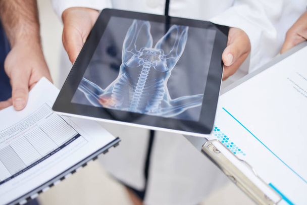 Doctor, hands and tablet with x ray in anatomy, surgery or results in MRI, CT or body scan at hospital. Closeup of medical professional team with technology or documents in patient analysis at clinic. - Photo, Image