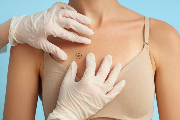 Dermatólogo examinando topo marcado de mujer joven sobre fondo azul, primer plano - Foto, Imagen