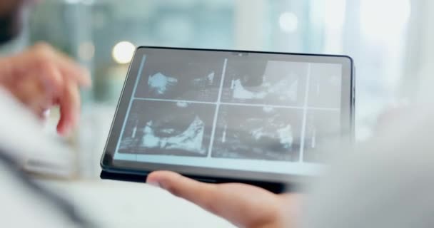 Doctor, hands and tablet with x ray in meeting, discussion or surgery planning together at hospital. Closeup of medical or healthcare professional team on technology in MRI, CT or body scan at clinic. - Footage, Video