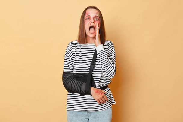 Caucasian young woman in striped shirt with bandage and bruised skin standing isolated over beige background screaming with hand near mouth calling to talk about violence - Foto, Imagen