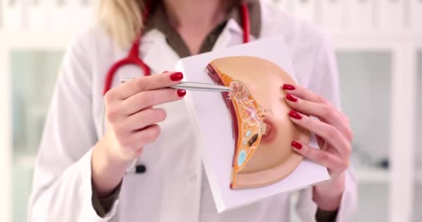 Medico femminile spiega la malattia e utilizza il modello anatomico del seno. Malattie delle ghiandole mammarie - Filmati, video