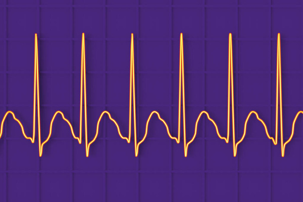 ECG dans le flutter auriculaire, un rythme cardiaque anormal caractérisé par des contractions rapides et régulières des oreillettes. Illustration 3D montrant les ondes P caractéristiques des dents de scie et le rythme ventriculaire irrégulier. - Photo, image