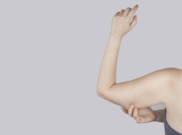 Liikalihavuus Selluliitti. Naisen käsivarressa roikkuva veltto iho. Ennen ja jälkeen. Käsitys laihduttamisesta, urheilusta, ruokavalion tarkistamisesta ja intensiivisestä koulutuksesta. Tuloksena laihdutus. Rasvaimu - Valokuva, kuva