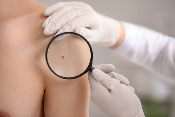 Dermatologist examining mole on young man's shoulder with magnifier in clinic, closeup - Photo, Image
