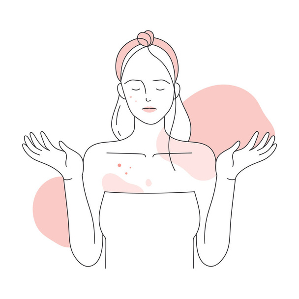 Bőrallergiás lány. Viszkető test bőr, borított piros kiütés vonal vektor illusztráció - Vektor, kép