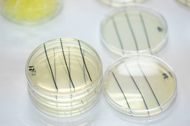 Анализ бактерий в креветках в лаборатории. - Фото, изображение
