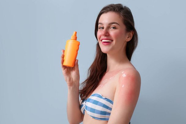 Alergická mladá žena s opálenou pletí a krémem na modrém pozadí - Fotografie, Obrázek