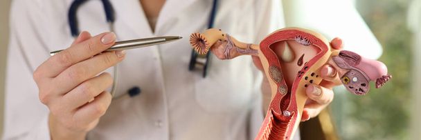 Close-up of practitioner holding anatomical model of uterus and ovaries, female reproductive organs. Healthy woman reproductive system, medicine, conception, education concept - Φωτογραφία, εικόνα