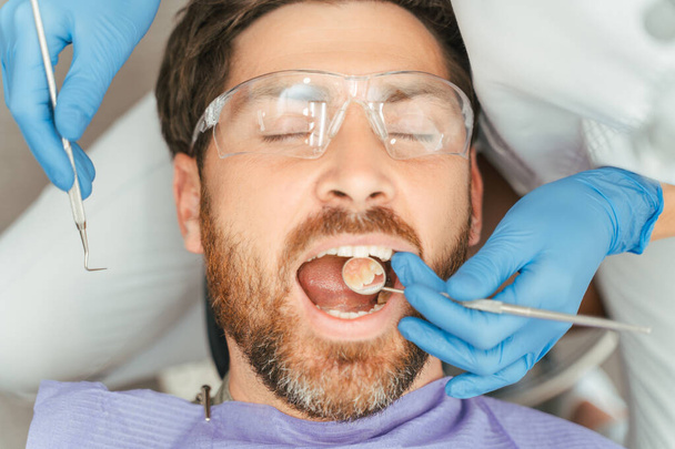 Portret van een aantrekkelijke man met een baard van middelbare leeftijd die in een tandartsstoel zit met een beschermende bril met open mond. Tandarts behandelt tanden met instrumenten. ? oncept van tandheelkundige zorg - Foto, afbeelding