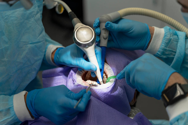Nyitott szájú páciens portréja, szelektív fókusz a fogorvos kezére, fogászati felszereléssel ellátott kezelési fogak. Professzionális fogorvos fogtisztítás, fehérítés, szájhigiénia. Fogászati ellátás fogalma - Fotó, kép