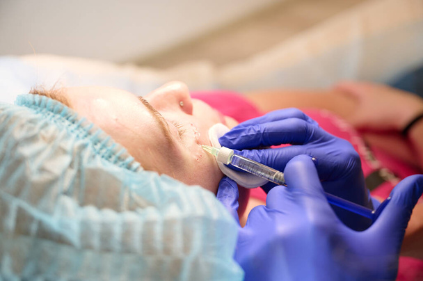 Kosmetologi ruiskuttaa ainetta potilaan muokkaamalla kasvot tehdä ei-kirurginen korjaus. Täyttöruiskeet. Esteettinen korjaavien hoitojen käsite. - Valokuva, kuva
