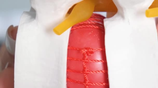 A close-up of a mock-up of an intervertebral hernia on the spine. Treatment of the spine. Vertical video - Footage, Video