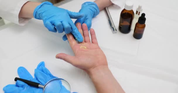 Dermatologista aplica pomada de cura para tratar a mão do paciente. Problema da pele da mão - Filmagem, Vídeo