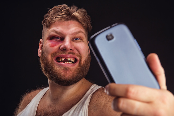 Uomo con lividi prende selfie
 - Foto, immagini