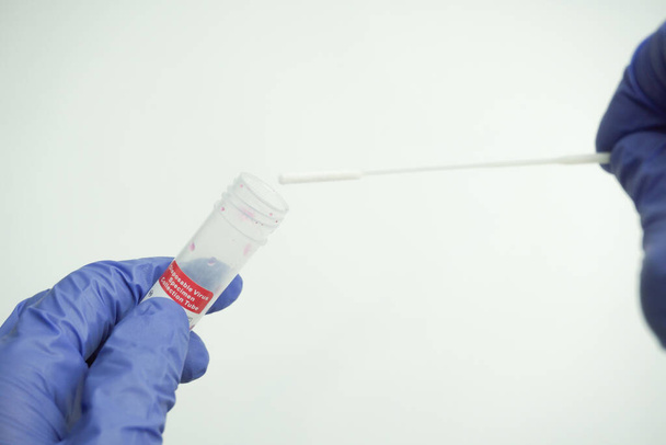 Reagenzglas und Wattestäbchen in den Händen eines Wissenschaftlers. Ein Virologe in Gummihandschuhen hält einen Laborkolben zur Analyse in der Hand. Er entnahm eine Abstrichprobe für einen Coronavirus-Test. - Foto, Bild