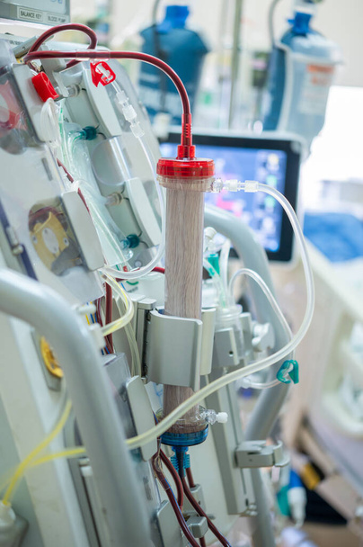 Gli esperti stanno preparando una macchina per la dialisi per l'uso in pazienti gravemente malati in unità di terapia intensiva ospedaliera. - Foto, immagini