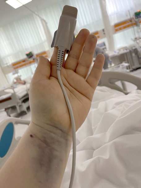Potilaan käsi pulssioksimetrianturilla sairaalan tehohoitoyksikössä - Valokuva, kuva