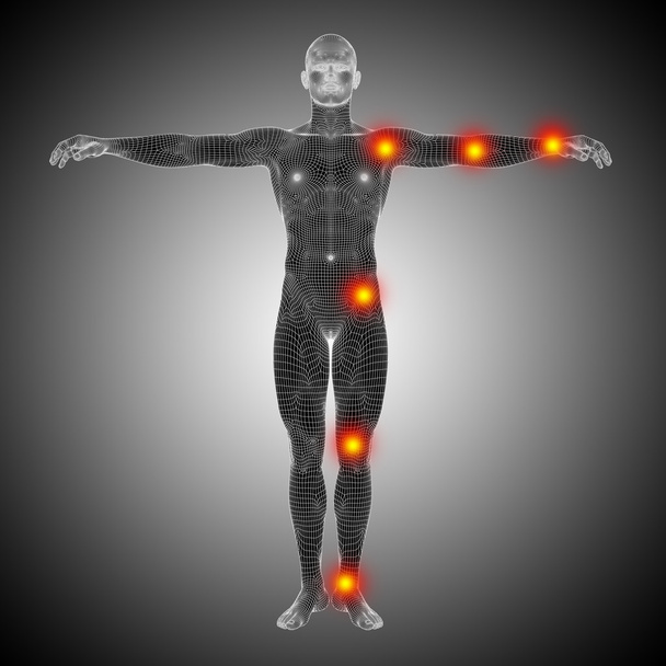 Menselijke anatomie gaas of op een draadframe lichaam met pijn - Foto, afbeelding