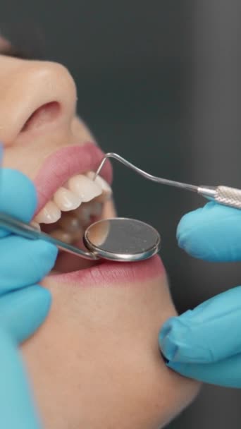 Επαγγελματικά διαγνωστικά στην κλινική και εντοπισμός προβλημάτων από οδοντίατρο. Ο ασθενής γνωρίζει ότι η επαγγελματική οδοντιατρική φροντίδα βοηθά στη διατήρηση ενός χαμόγελου. Διαδικασία επανεξέτασης σε πρώτο πλάνο. Υψηλής ποιότητας 4k - Πλάνα, βίντεο