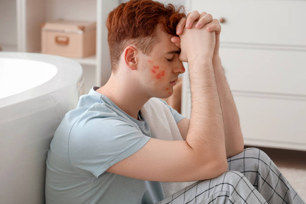 Sad teenage boy with acne in bathroom - Photo, Image
