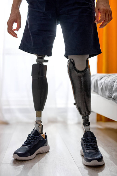 Disabled young unrecognizable man with leg prosthesis in sneakers standing indoors at home in bright room, cropped photo. modern leg prosthesis - Foto, Imagem