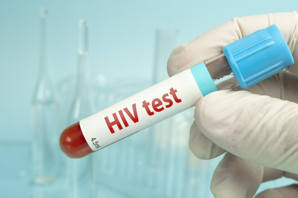 Hand holding blood sample for HIV test on a blue laboratory background. - Photo, Image