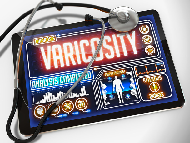Varicosity a kijelzőn, orvosi tabletta. - Fotó, kép