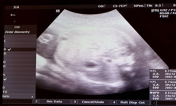 Ultrahangvizsgálat egy egészséges magzatot mutató terhes nő méhén, anyai ultrahang a terhesség alatt, terhességi követés és a magzat egészségi állapotának koncepciója, ultrahangos orvosi vizsgálat - Fotó, kép