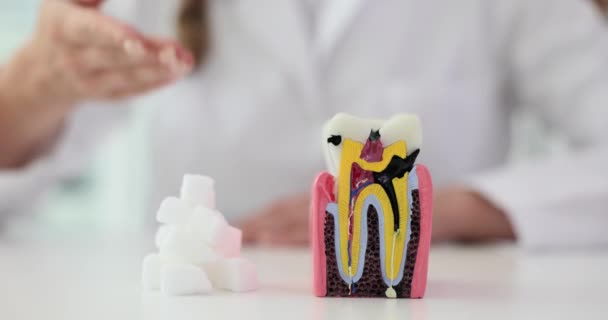 Karies und Zucker im Mundbereich zerstören den Zahnschmelz. Zahn mit Karies weißen Zuckerwürfeln - Filmmaterial, Video