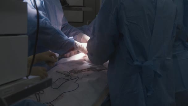 Lähellä kirurgit kirurgiset puvut toimivat potilaan leikkauksessa. Sairaanhoitaja antaa työkaluja lääkäreille ja muuttaa imukykyistä puuvillaa. Naispuolisen lääkärin tarkastukset potilaan tila monitorissa. - Materiaali, video