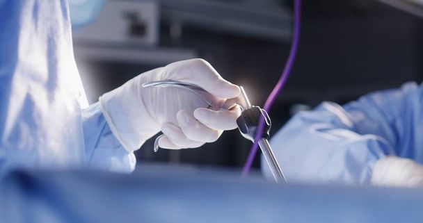 Χέρια κοντά σε επαγγελματίες χειρουργούς που εκτελούν εργασίες χρησιμοποιώντας λαπαροσκοπικά εργαλεία. Το ιατρικό προσωπικό μαζί σώσει σοβαρά τραυματισμένο ασθενή στο χειρουργείο. Ιατρικές εργασίες σε σύγχρονες ιατρικές εγκαταστάσεις. - Φωτογραφία, εικόνα