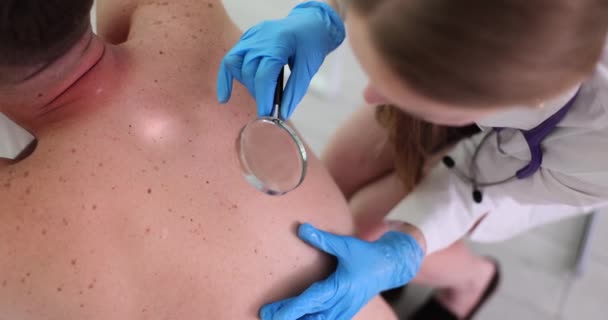 Dermatoloog kijkt naar moedervlekken op de mens terug door vergrootglas. Man terug met veel moedervlekken op de huid - Video