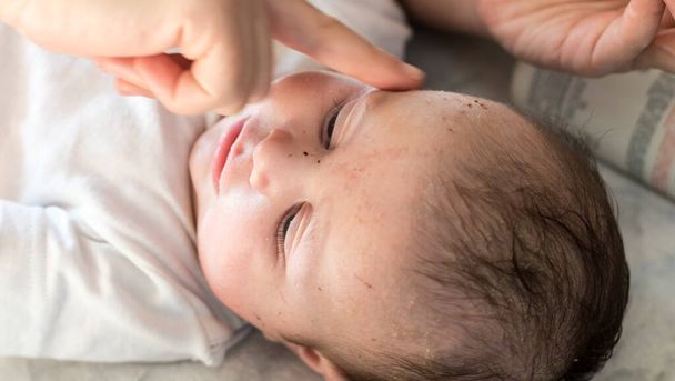 Äiti laittaa kosteusvoide hänen muutaman kuukauden ikäinen vauva - Valokuva, kuva