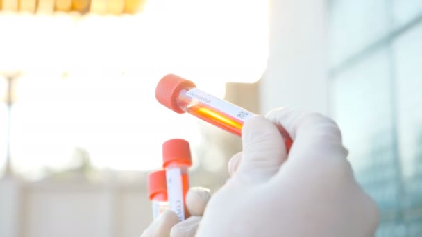 Testbuisjes met bloedmonsters naar het coronavirus in de hand van een arts of laboratoriummedewerker. Arm van de arts die bloedmonsters van patiënten test op het COVID-19 virus. Concept van gezondheid en veiligheid als gevolg van een pandemie. Sluitingsdatum - Video