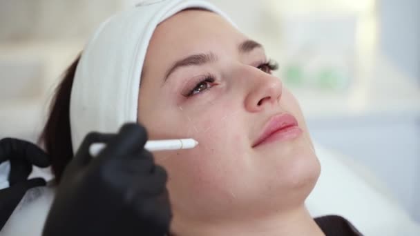 注射またはプラスチック外科医のコンサルティング患者を作るために顔面の領域をマーキング化粧品のクローズアップショット - 映像、動画