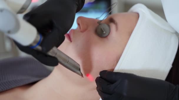 nő pihentető kozmetikai klinika alatt lézer fiatalító kezelés, esztétikus dolgozik lézer alvadási kapillárisok, modern szépség technológia - Felvétel, videó